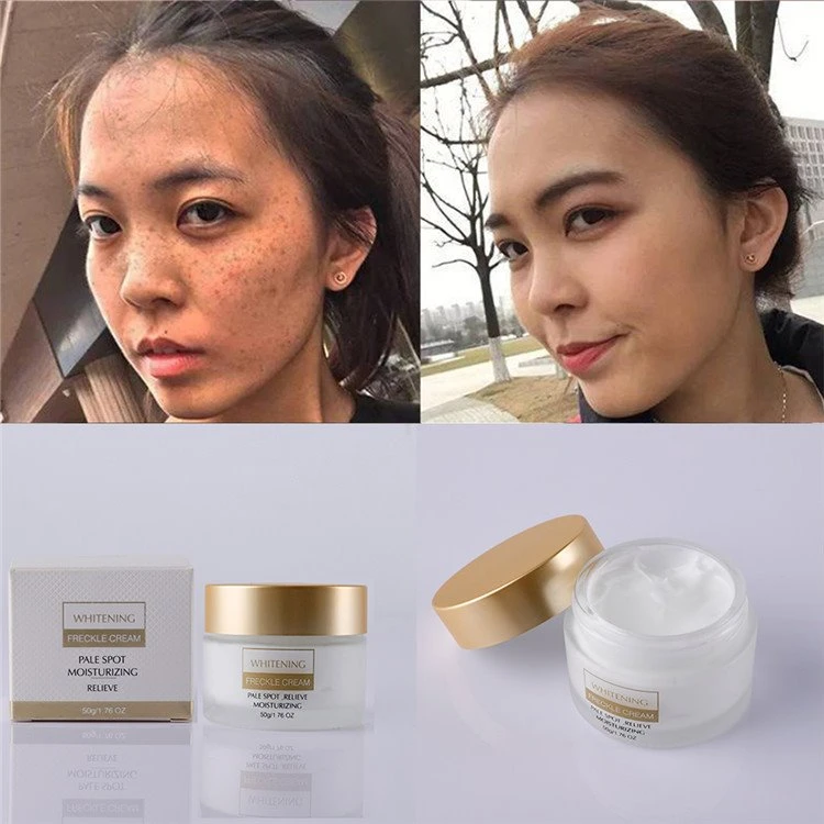 Nägu Freckles Removal Cream