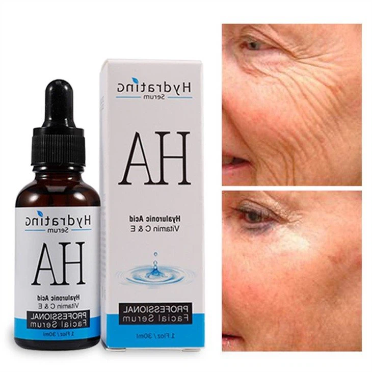 anti wrinkle serum hyaluronic acid